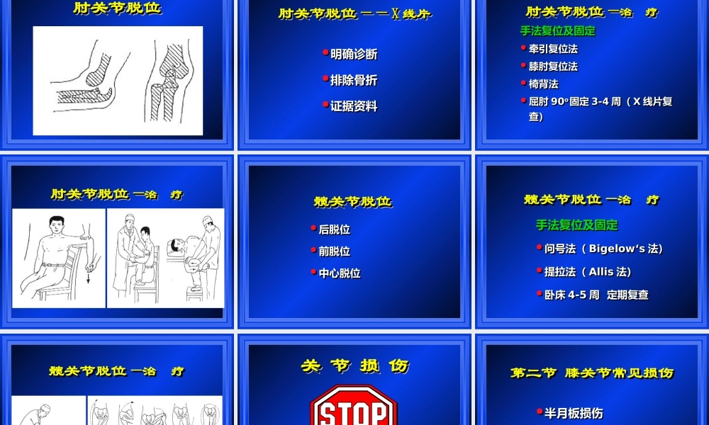关节损伤.ppt