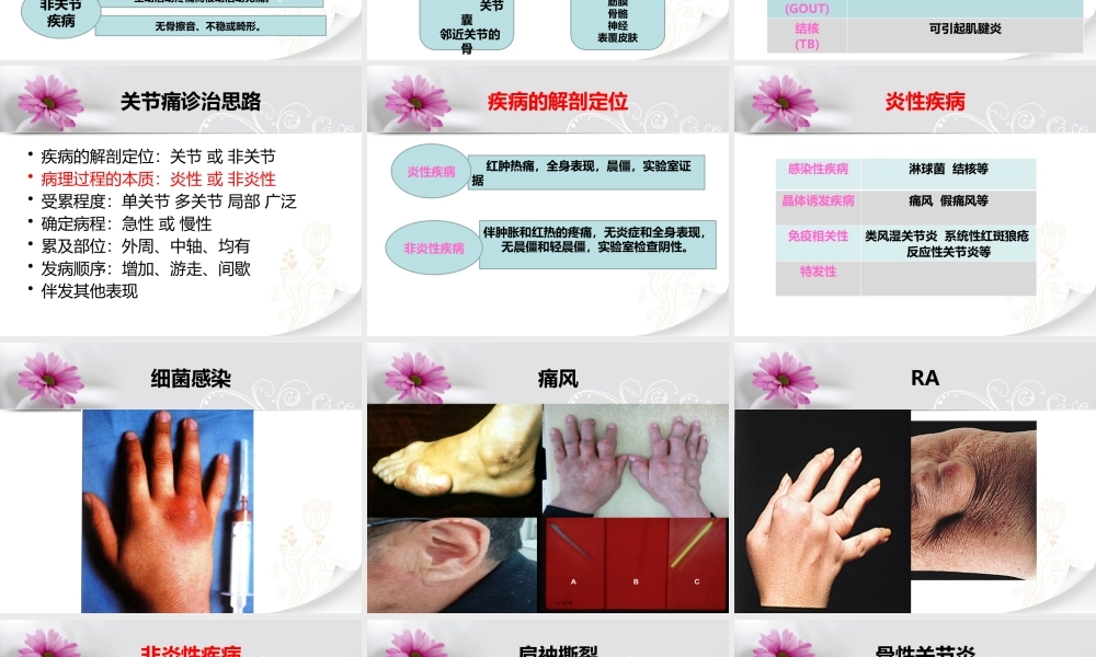 关节痛的诊治思路.pptx