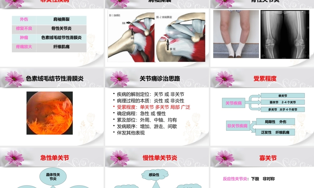 关节痛的诊治思路.pptx