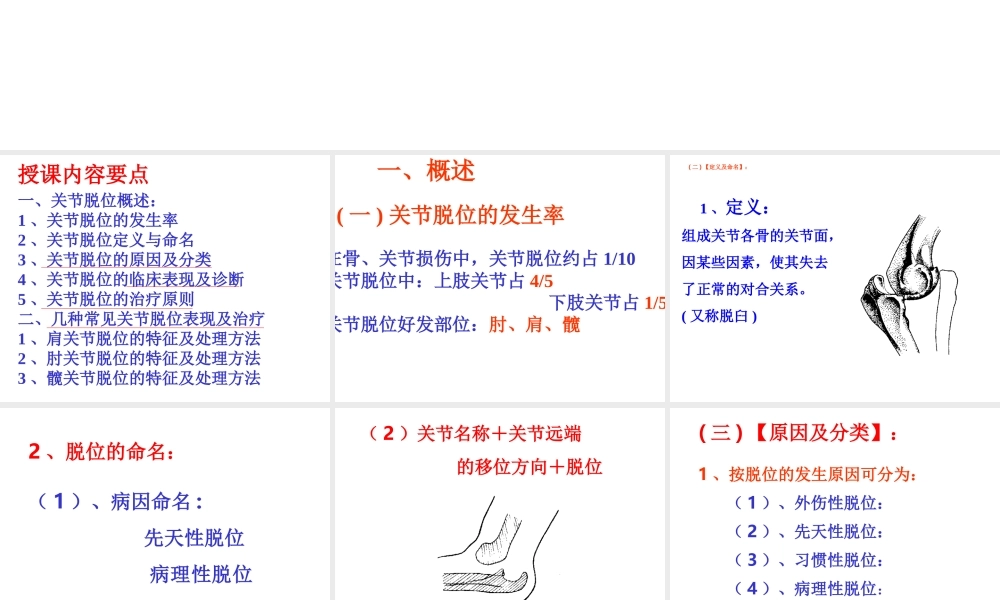 关节脱位(本).ppt