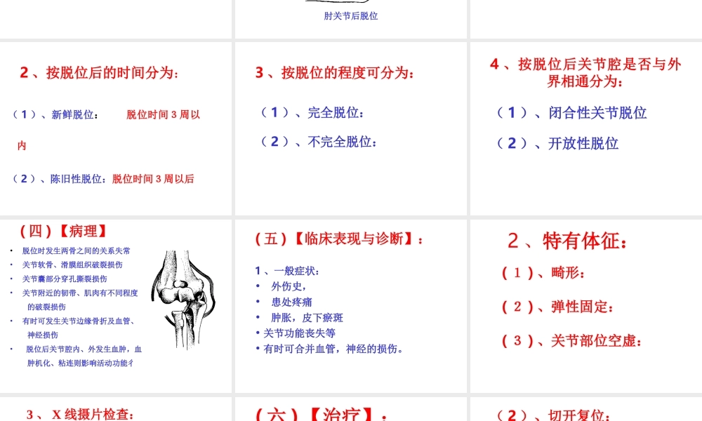 关节脱位(本).ppt