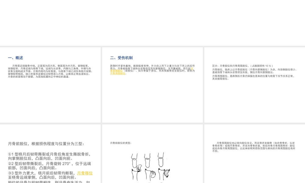 月骨脱位与月骨周围脱位.ppt