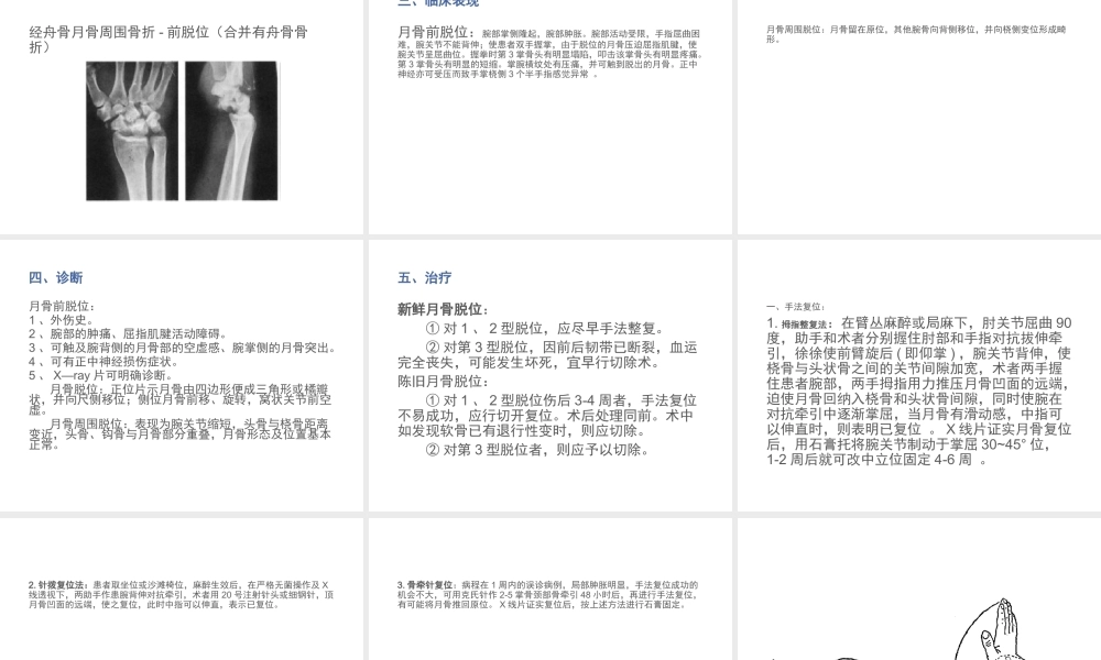 月骨脱位与月骨周围脱位.ppt