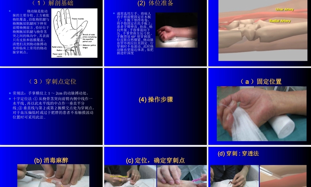 有创血压监测讲课.ppt