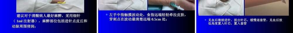 有创血压监测讲课.ppt