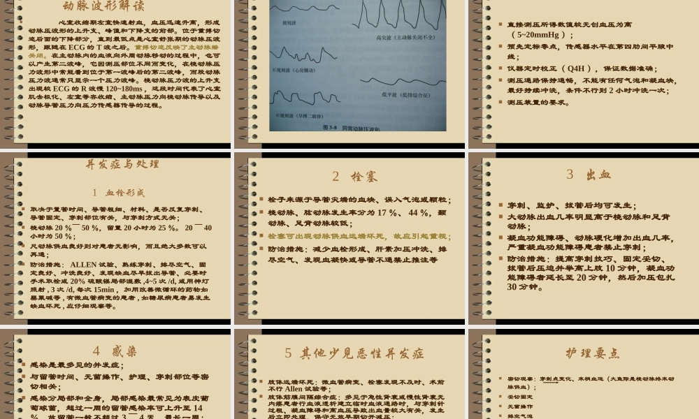 有创动脉压监测..ppt