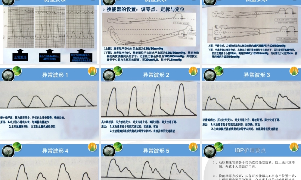 有创动脉血压的监测.ppt