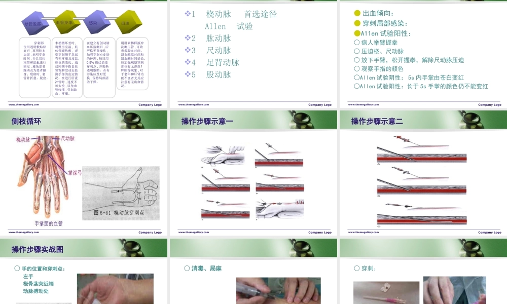 有创动脉压监测.ppt