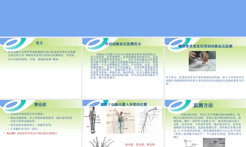 有创血压监测陈瑶.ppt