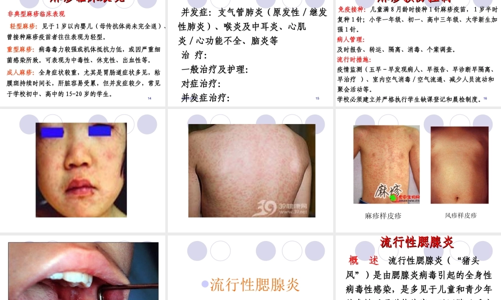 春秋季学校传染病.ppt