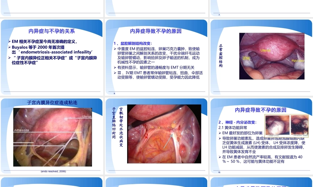 内异症与不孕.ppt