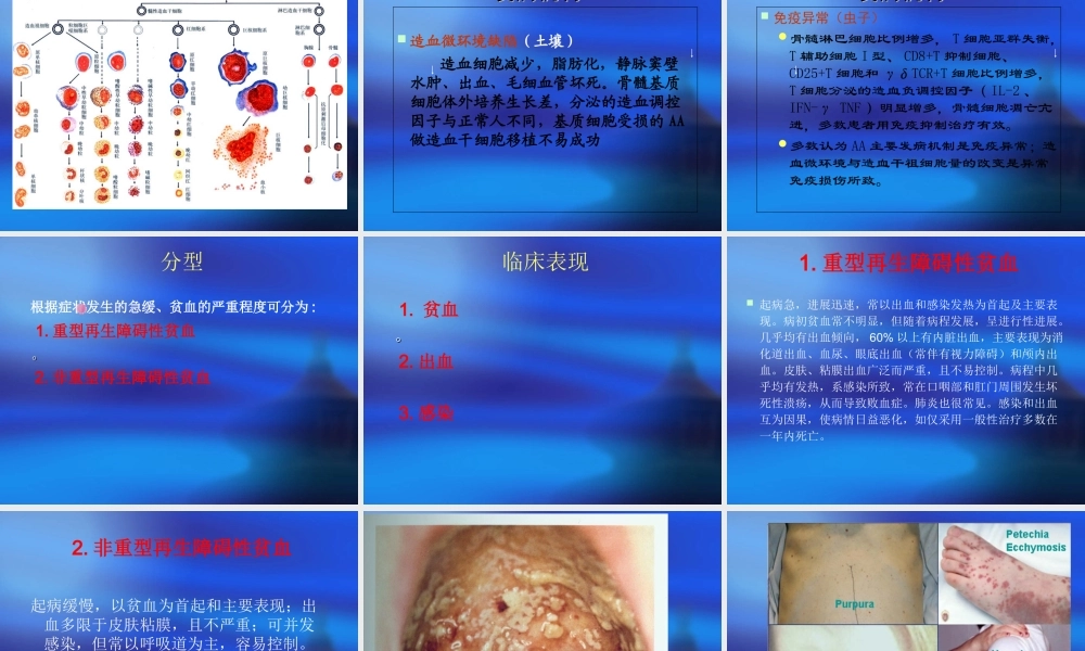 再生障碍性贫血讲课.ppt