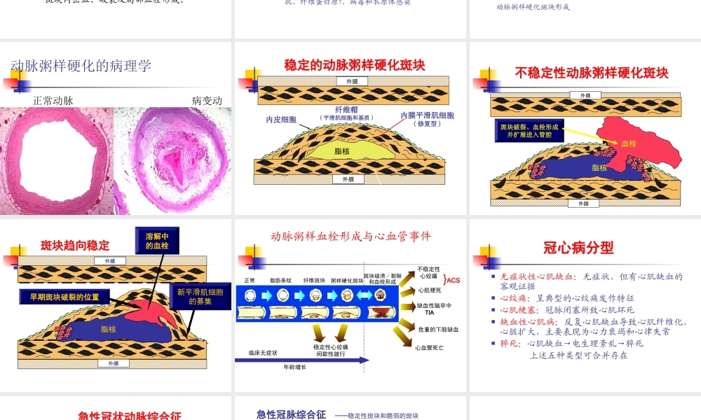 冠心病心绞痛.ppt