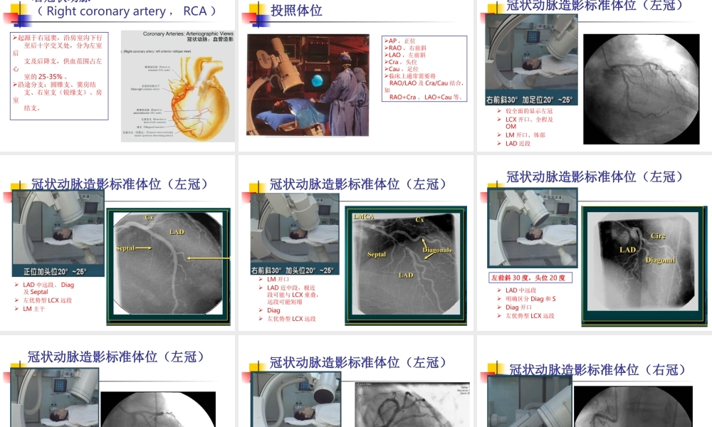 冠状动脉造影.ppt