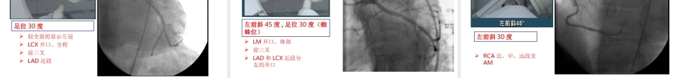 冠状动脉造影.ppt