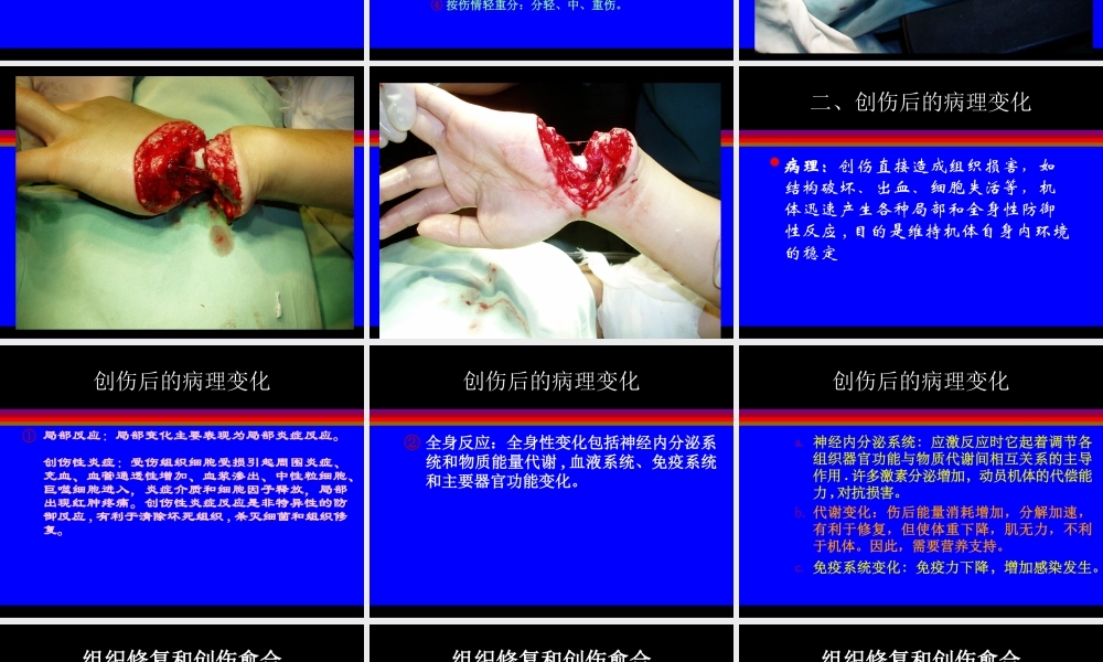 创伤和战伤.ppt
