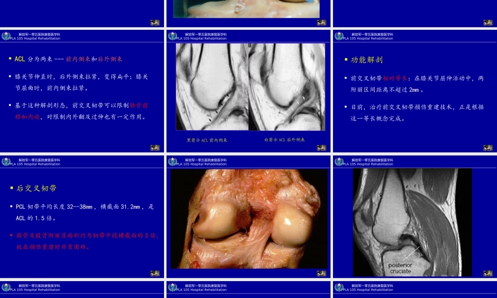 创伤性膝关节功能障碍的康复.ppt