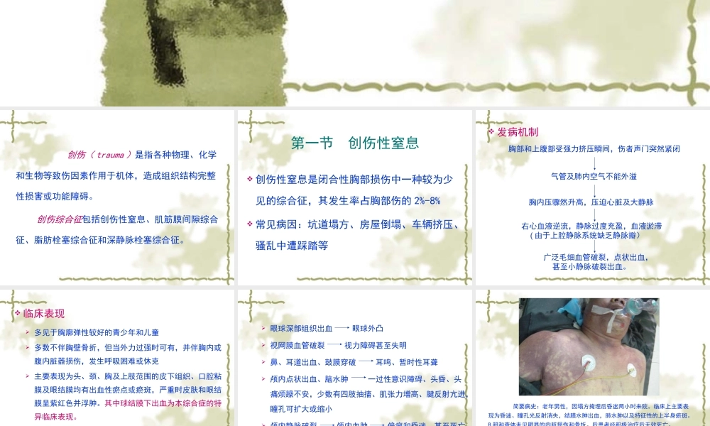 创伤综合征(xiugai)剖析.ppt