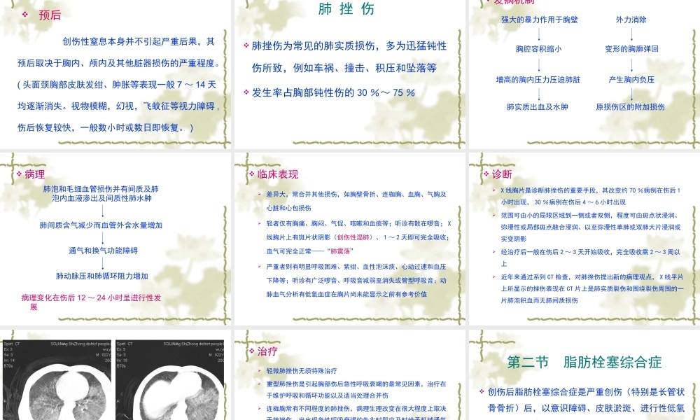 创伤综合征(xiugai)剖析.ppt