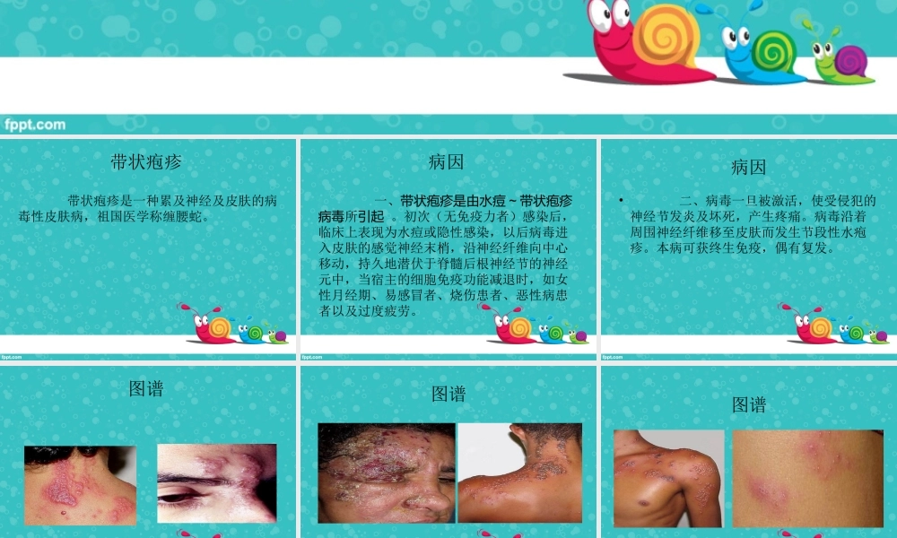 带状疱疹健康讲座.ppt