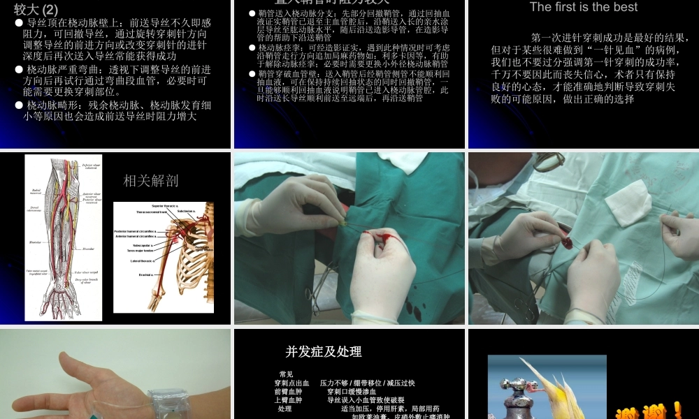 桡动脉穿刺技巧、常见问题和并发症的处理.ppt