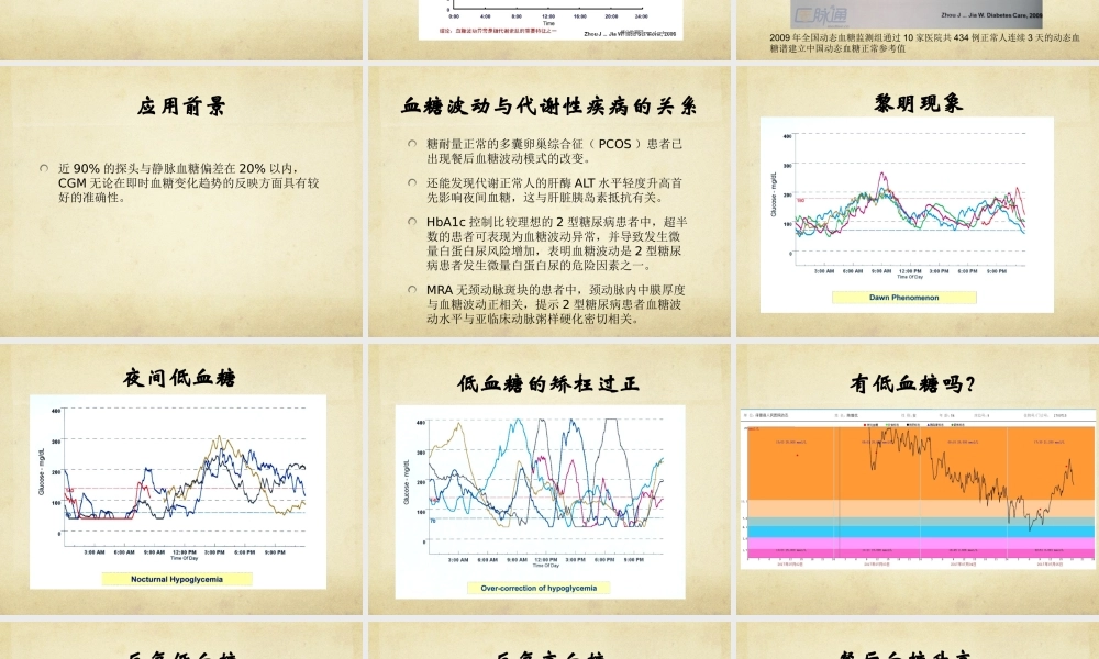 动态血糖监测.pptx