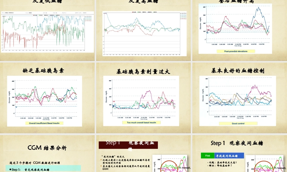 动态血糖监测.pptx