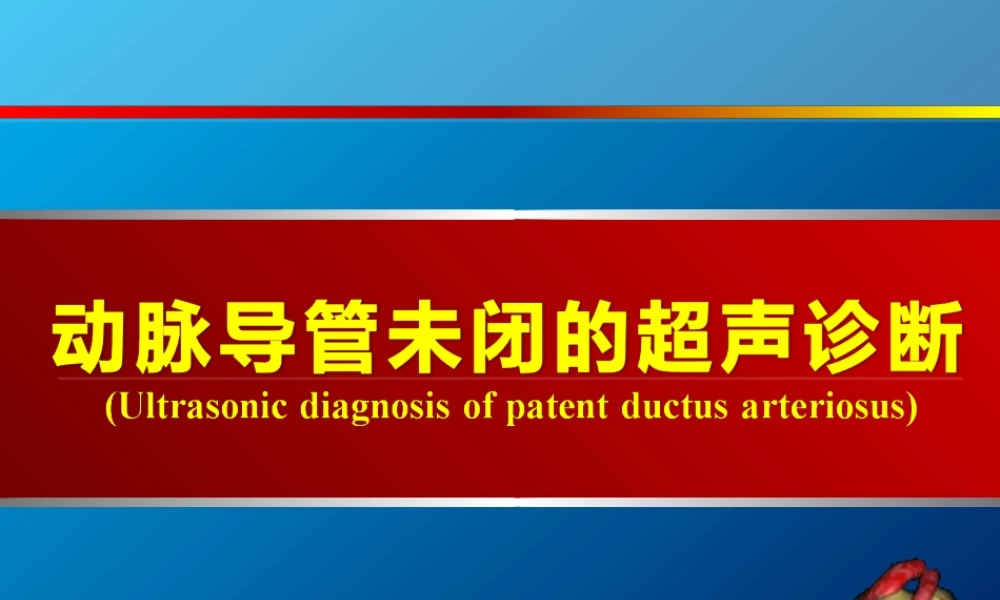 动脉导管未闭、主动脉狭窄.ppt