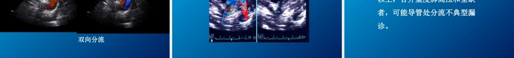 动脉导管未闭、主动脉狭窄.ppt