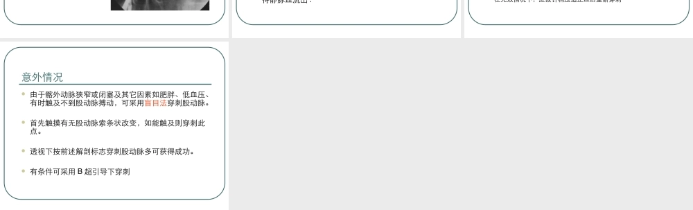 动脉穿刺技巧.ppt