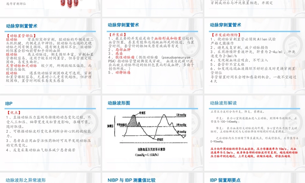 动脉穿刺置管术及IBP.ppt