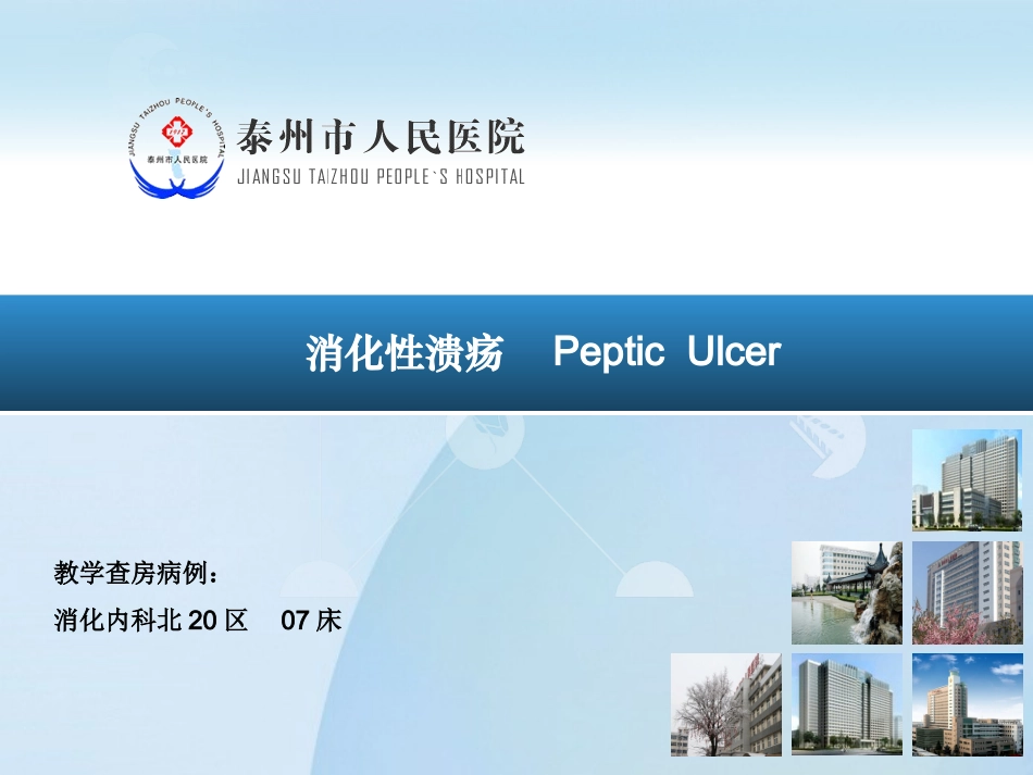 消化性溃疡诊治进展.ppt_第1页