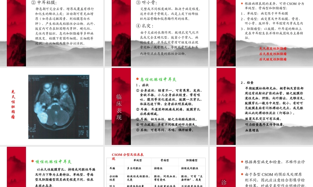 化脓性中耳炎及其并发症.ppt