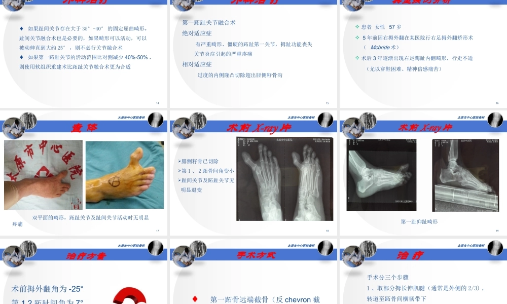 医源性拇内翻2015.11.1--杜虎羽.ppt