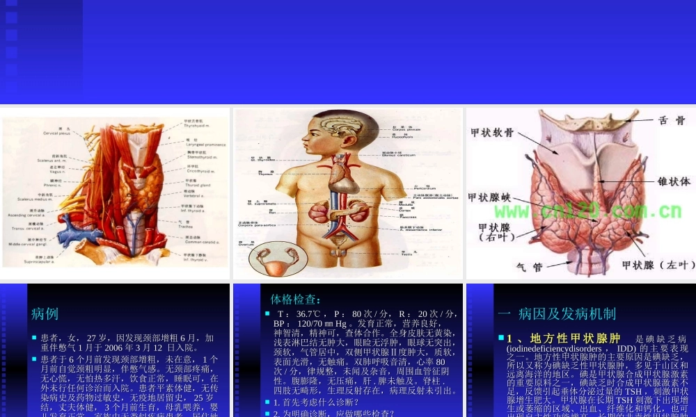 单纯性甲状腺肿.ppt