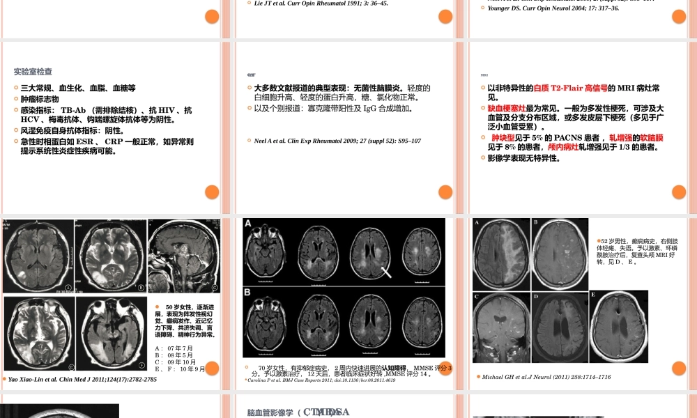 原发性中枢神经系统血管炎.pptx