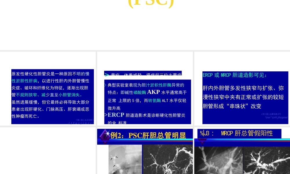 原发性硬化性胆管炎.pptx