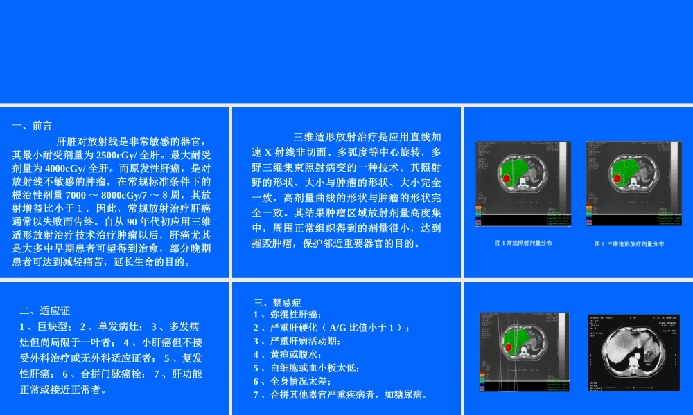 原发性肝癌的三维适形放疗.ppt