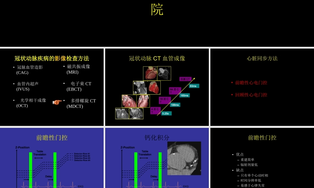 多排螺旋CT在冠状动脉成像中的应用.ppt