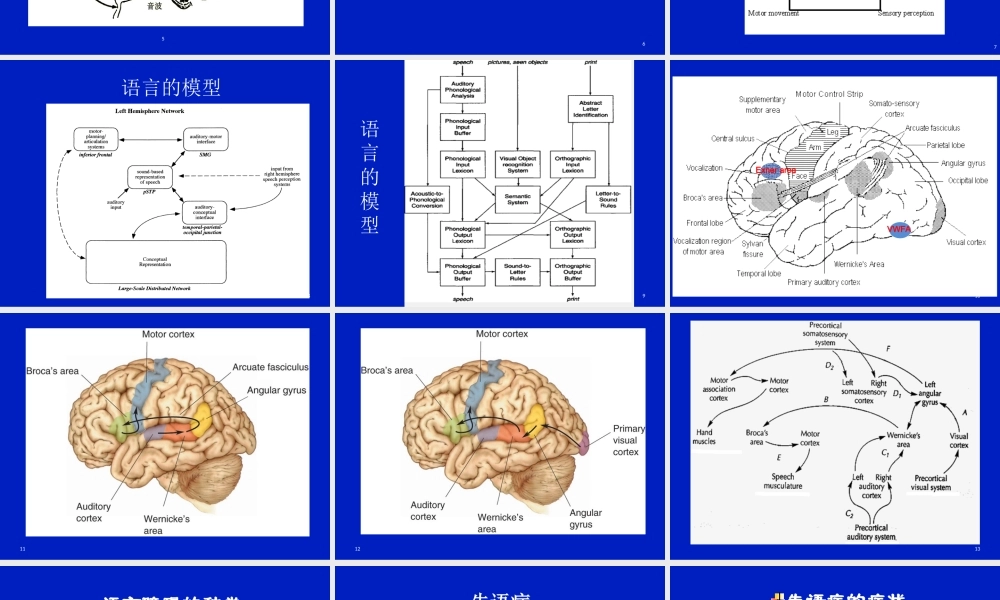 失语症概述-单春雷剖析.ppt