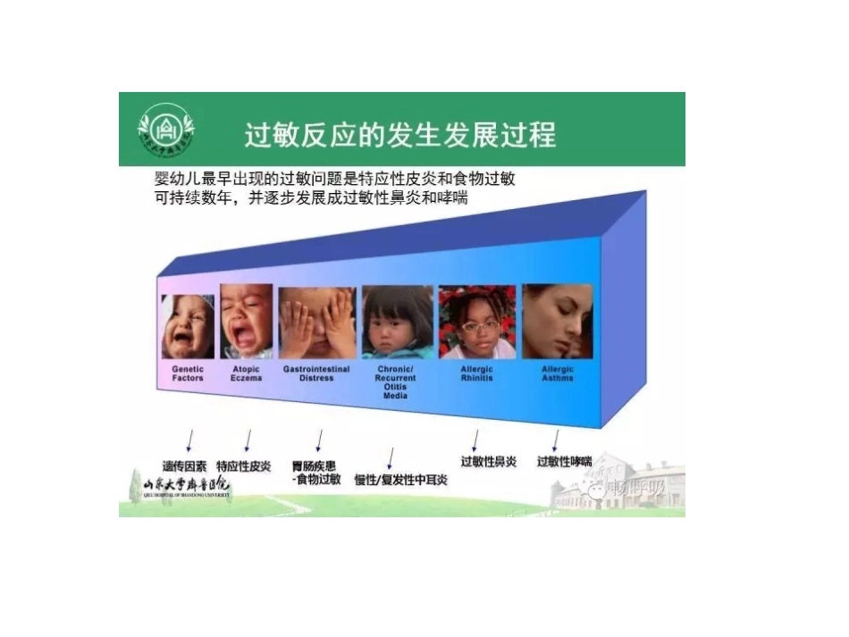 特异性皮炎-儿童.pptx_第3页