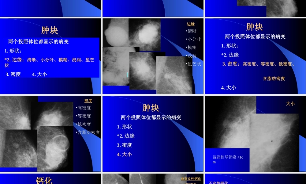 如何读懂乳腺钼靶片.ppt