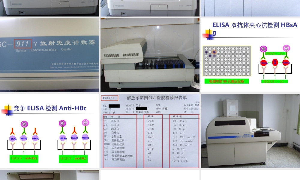 如何看肝病化验单.ppt