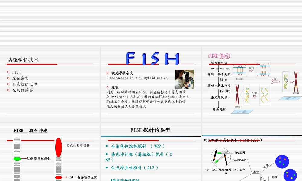 子宫颈鳞状上皮病变中HPV感染.ppt