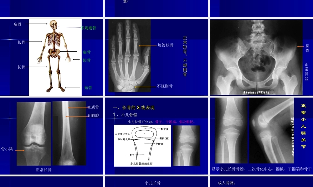 实习1---骨与关节正常表现.ppt