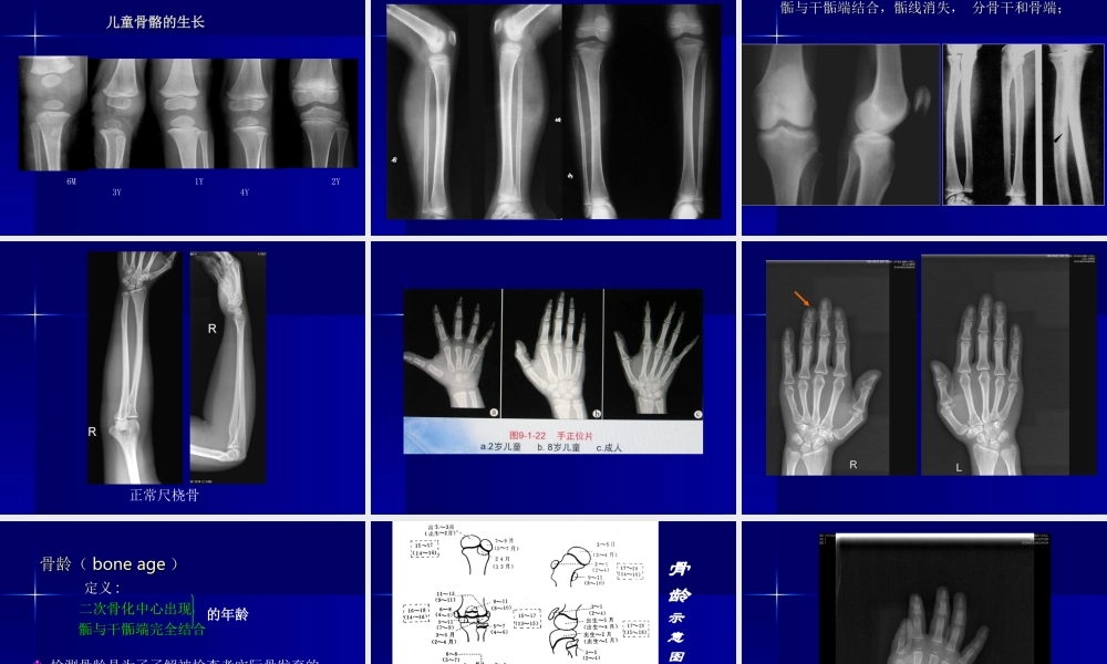 实习1---骨与关节正常表现.ppt