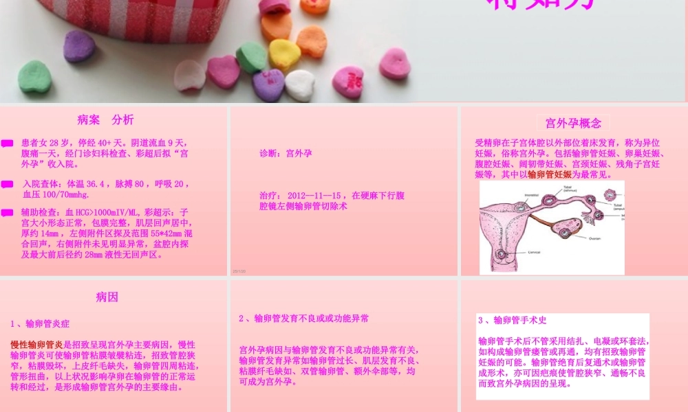 宫外孕个案查房.ppt