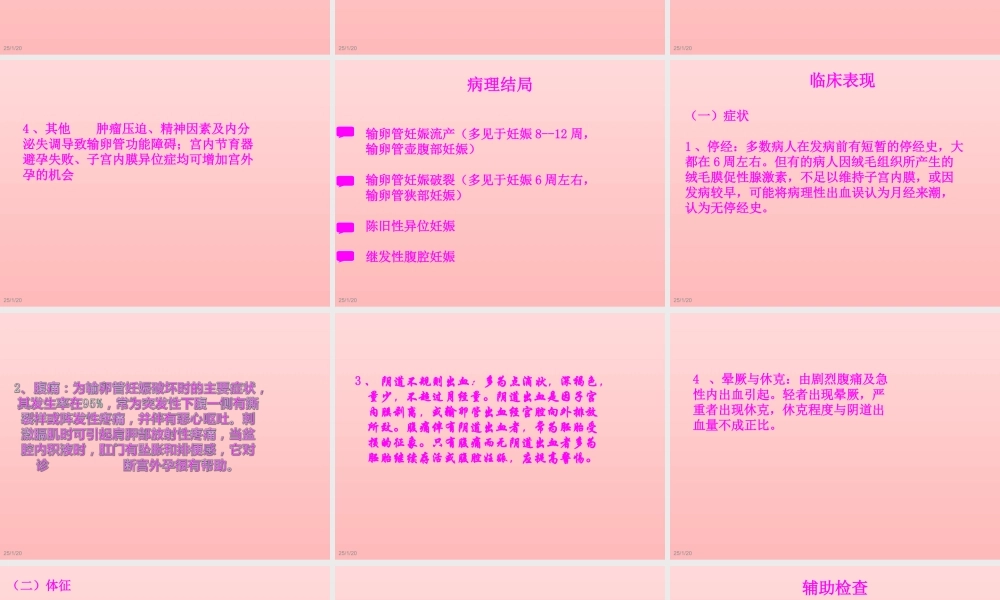 宫外孕个案查房.ppt