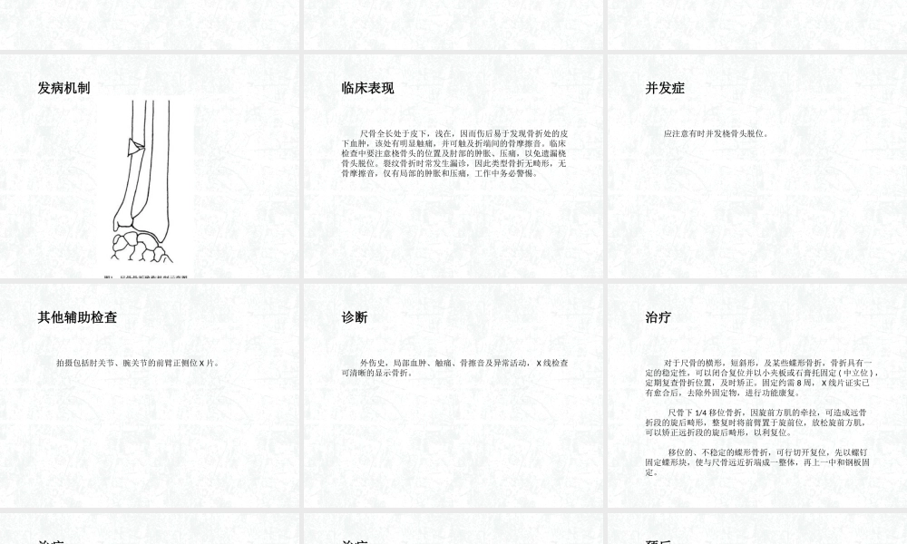 尺骨干骨折概述.ppt