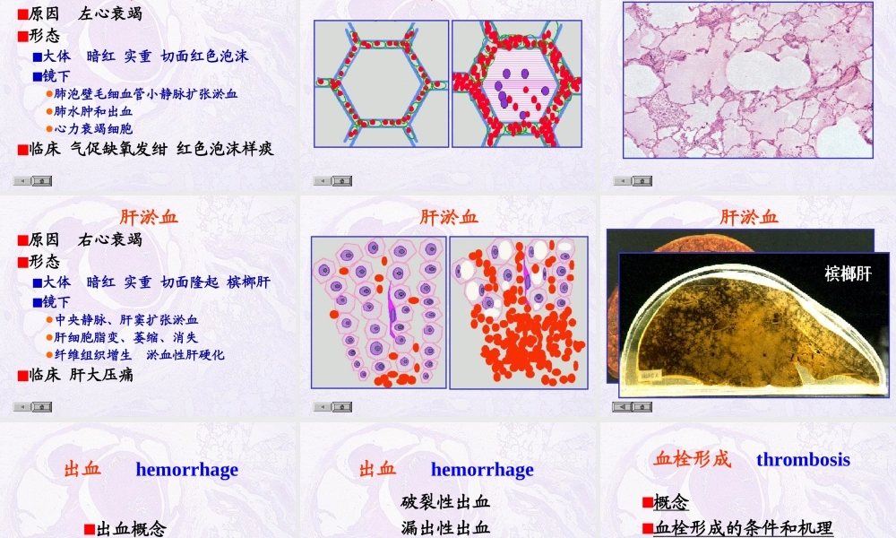 局部血液及体液循环障碍.ppt